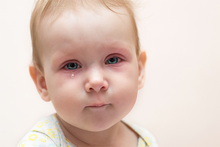 Taking your baby to the ophthalmologist